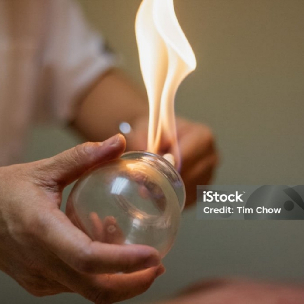 Fire CUPPING at Seal Beach Massage & Wellness in Seal Beach, CA