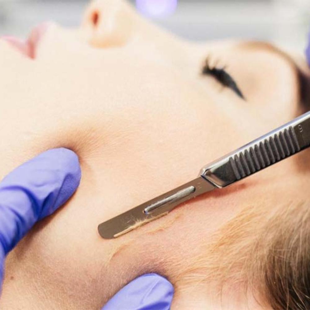 Dermaplane Facial