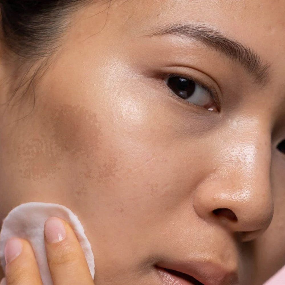 Even Tone TCA Peel at SKINDESIGN BY SAM D. in Massapequa, NY