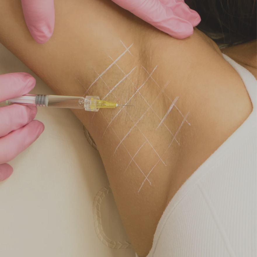Sweat Control Tox- Underarms at Plush Lash + Era Aesthetics in Alexandria, VA