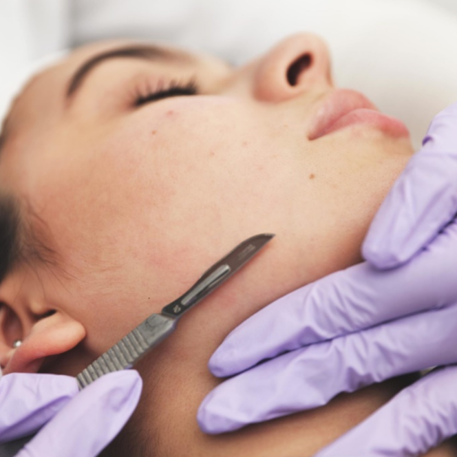 Dermaplaning - Marcia at Worthy of Wellness LLC in Winter Park, FL
