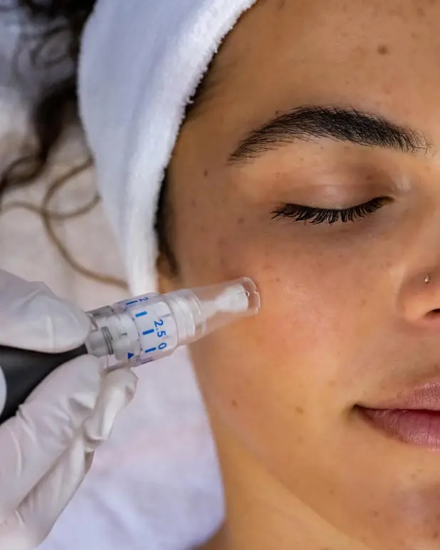 CIT Collagen Induction Therapy