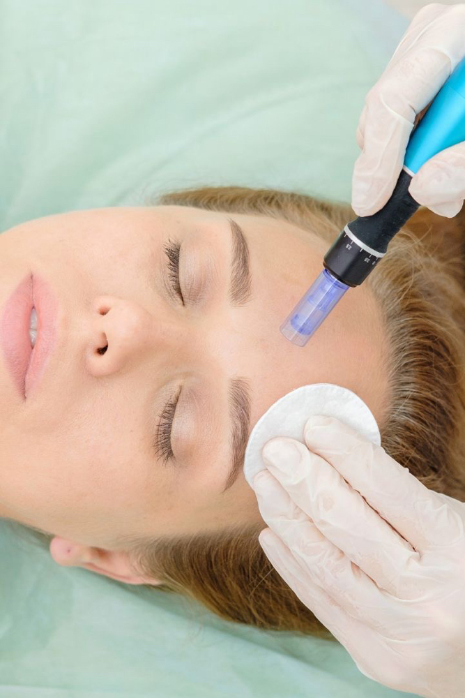 Glow Renewal Microneedling at celi esthetics in Smithtown, NY