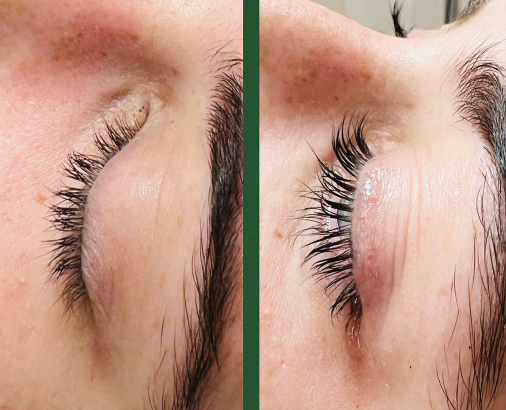 Lash Lift