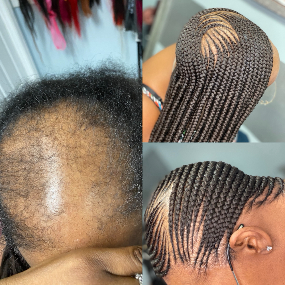 Hairloss /Alopecia Braids at Tobs braiding salon llc in Houston, TX