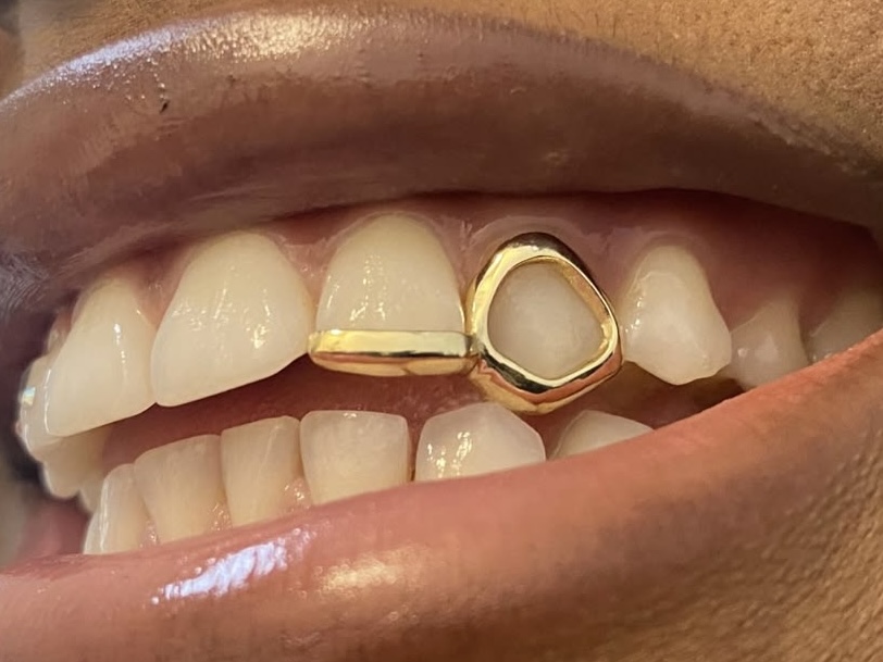 18K Gold Cap