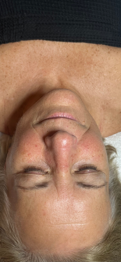 Circadia’s SWiCH Treatment 🦋