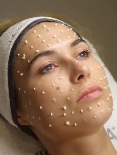 COMING SOON! Liquid Microneedling!