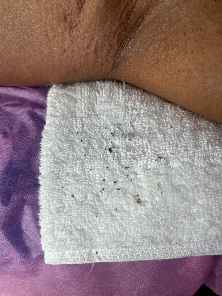 Underarm Detox (includes wax)