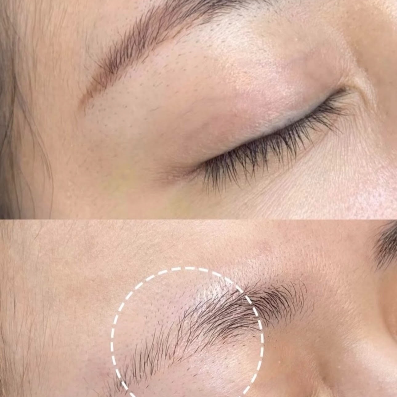 Laser Brow Tattoo Removal at DBW BROW ARTISTRY in City of Industry, CA
