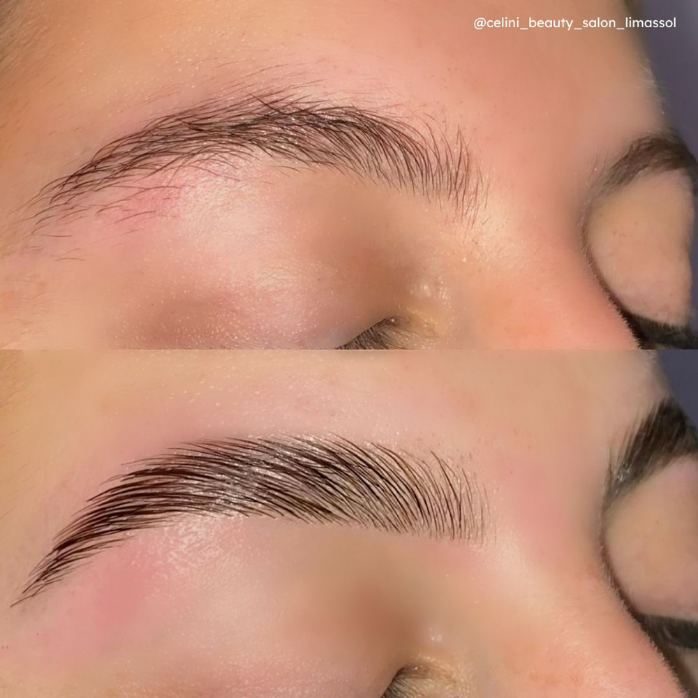 Brow Lamination