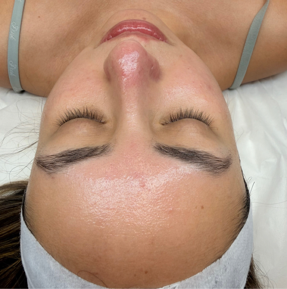 Deep Facial Cleansing at Estediva Aesthetics in Long Island City, NY