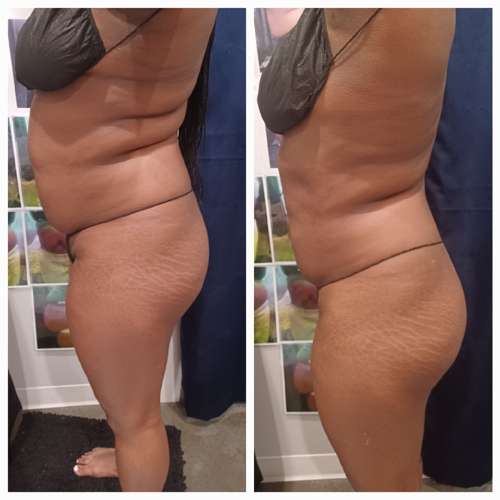 STOMACH & BOOTY LIFT