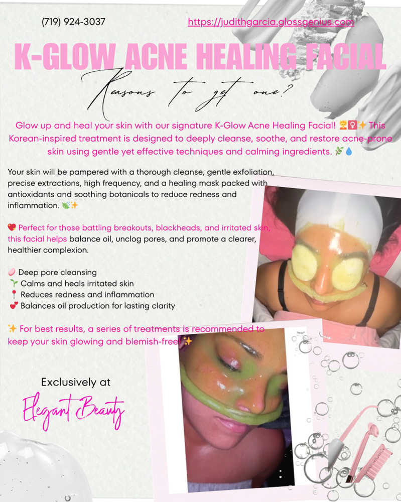 ✨K:GLOW HEALING FACIAL; PARA ACNE✨