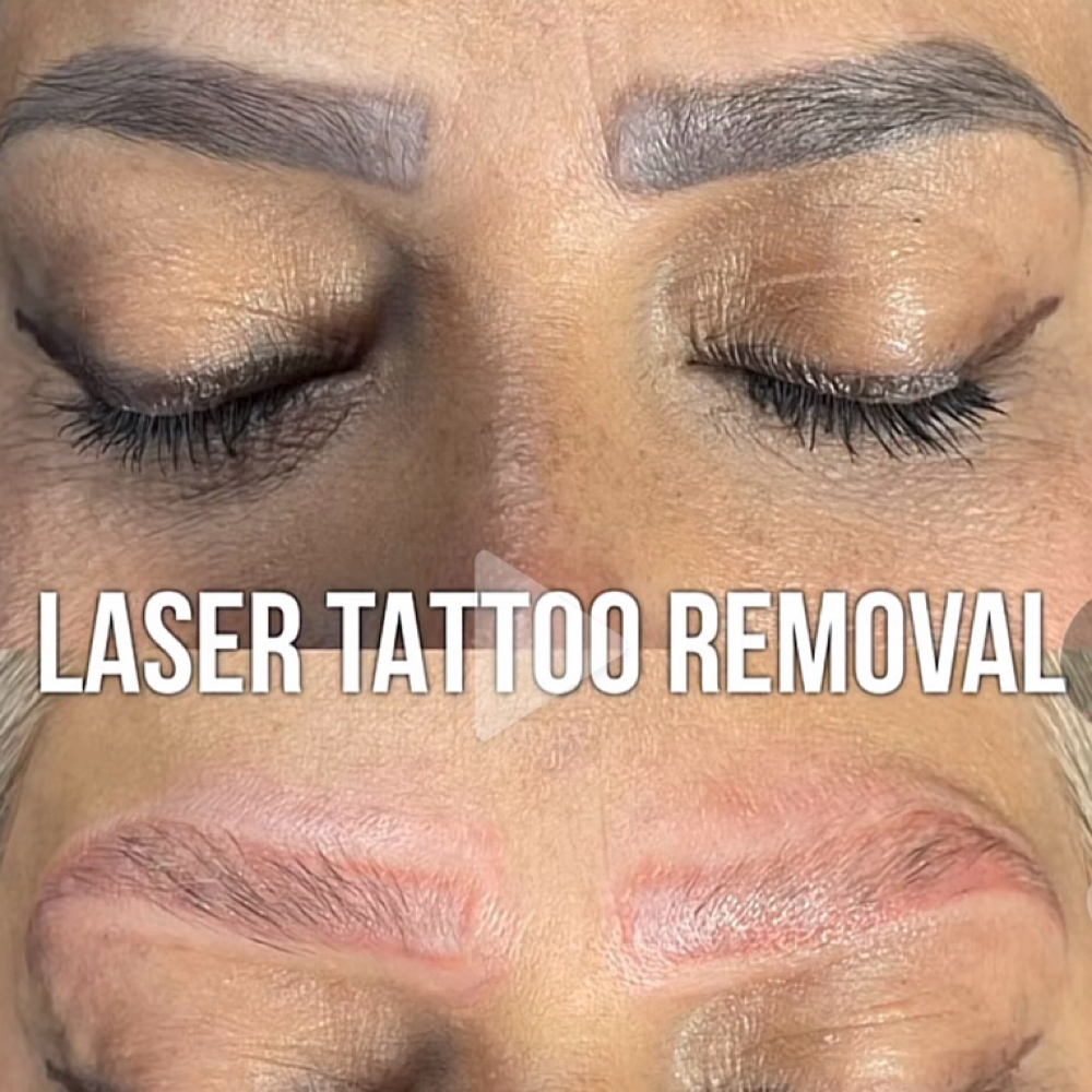 ✨Eyebrow Tattoo Removal✨ May Promo at Nena’s Beauty Glow Bar in North Las Vegas, NV