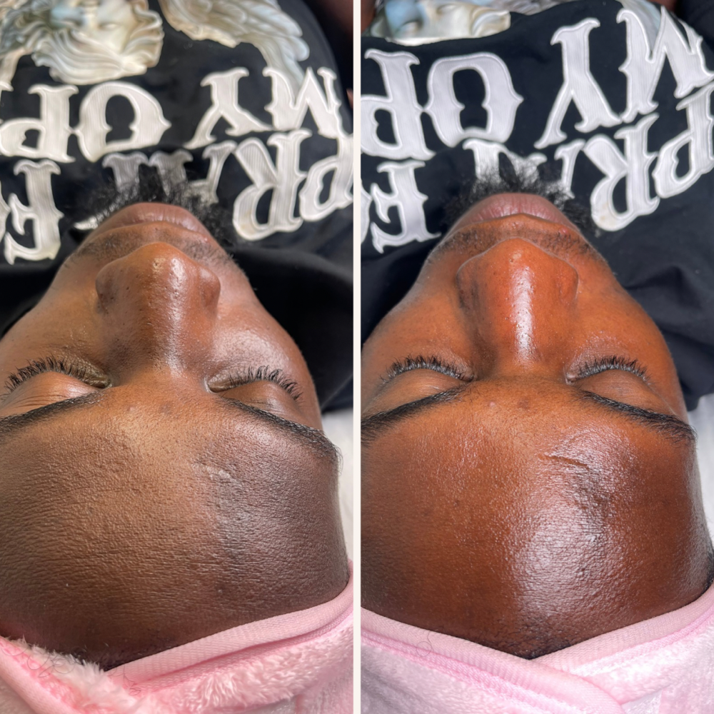 Men’s Facial