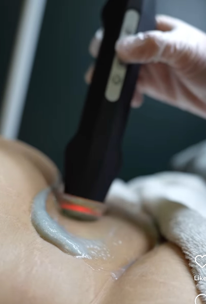 Oxygen Treatment Vajacial