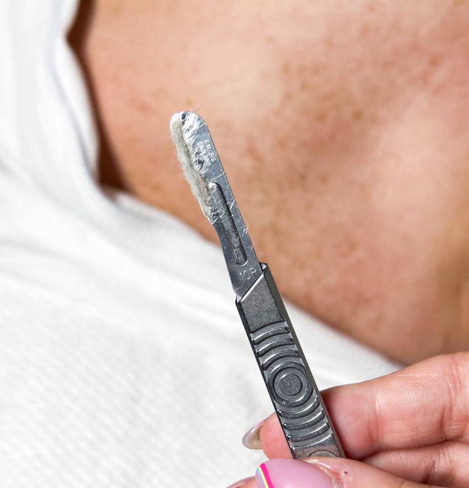 Dermaplaning Facial