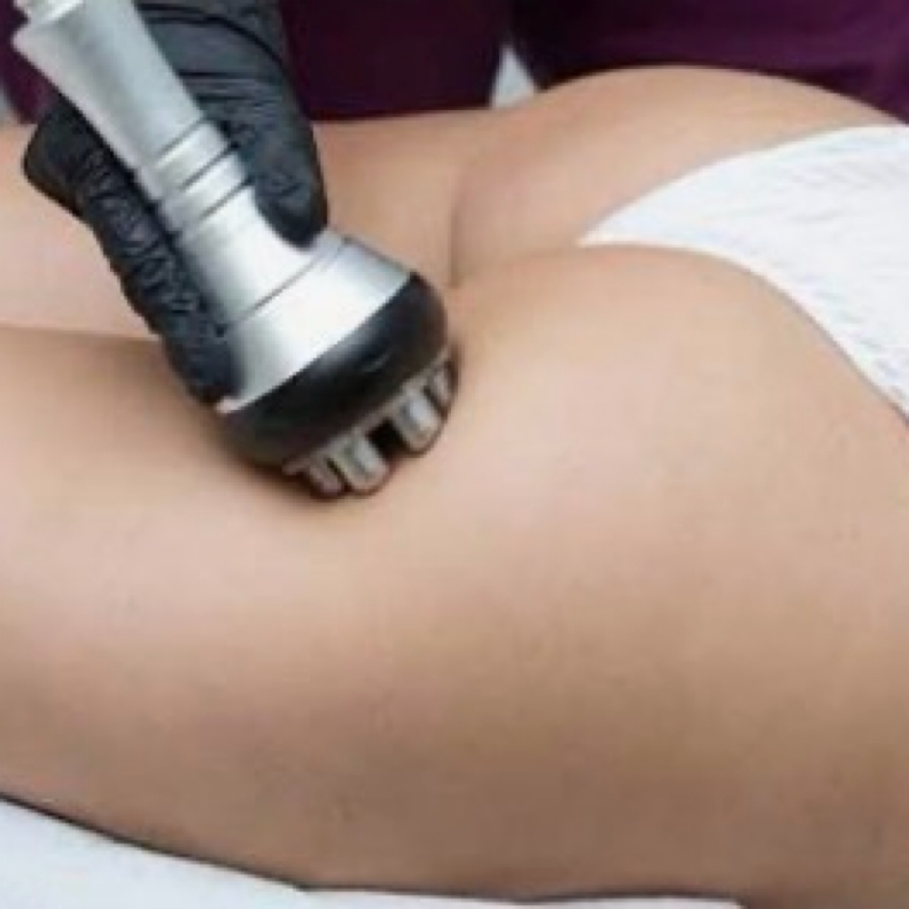 CELLULITE TREATMENT at BLAZEBODYSPA & BEAUTY BAR in TINLEY PARK, IL