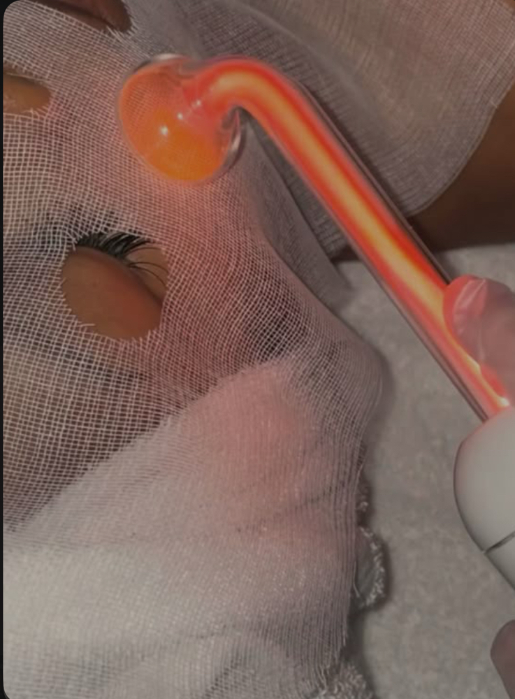Acne-clearing facial