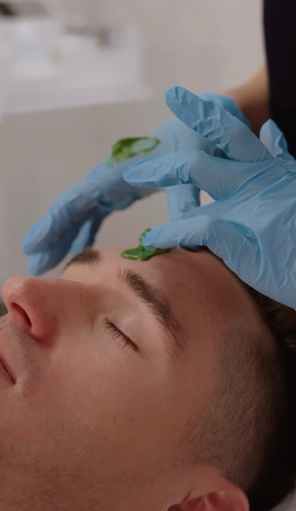 Aerolase and Micro-Needling