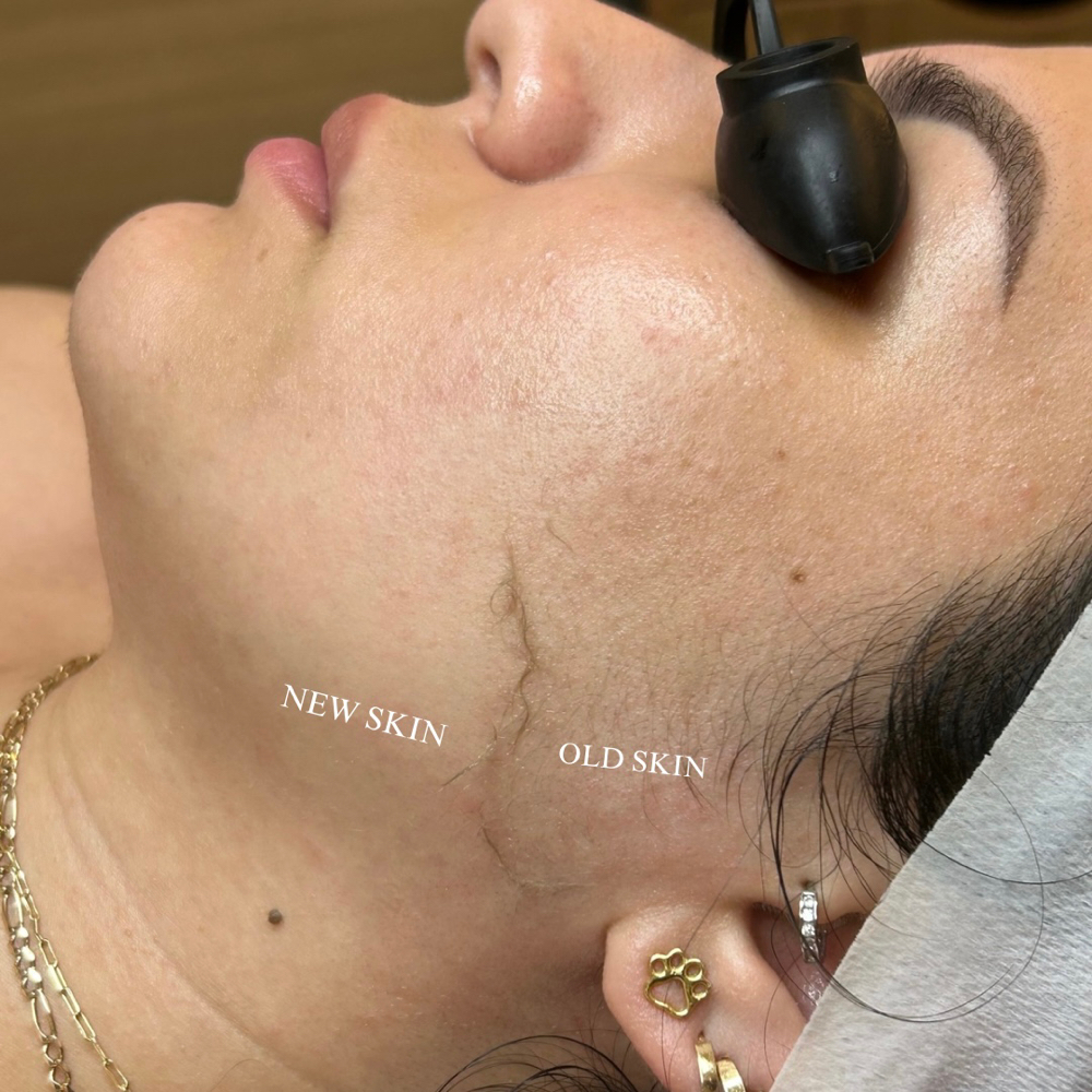 Rejuvenating Facial