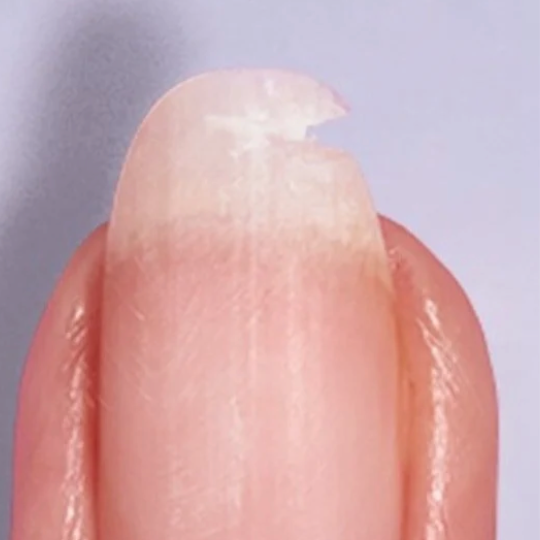 Nail Repair at with love beauty bar in Brooklyn, NY