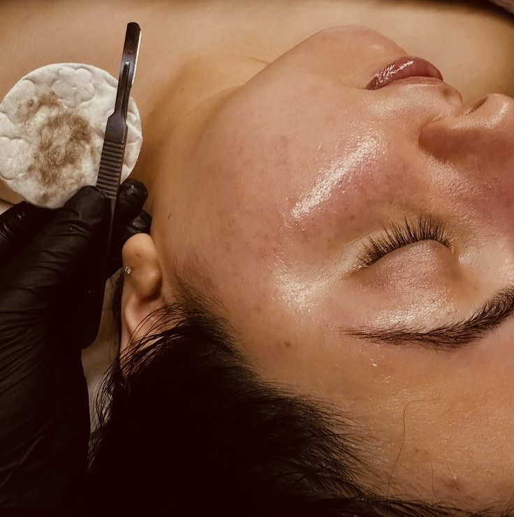 Full Dermaplane + Enzyme Mask