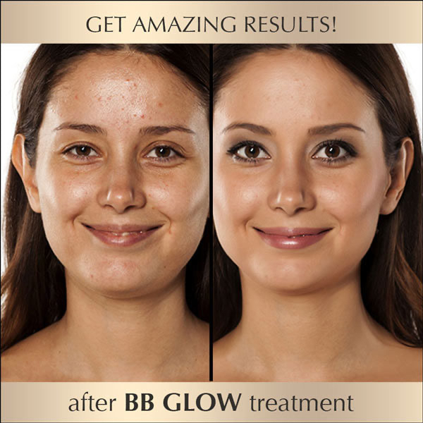 BB Glow Treatment