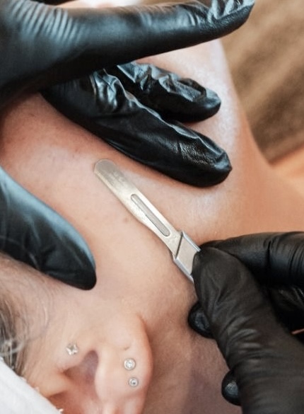 Dermaplane Add On