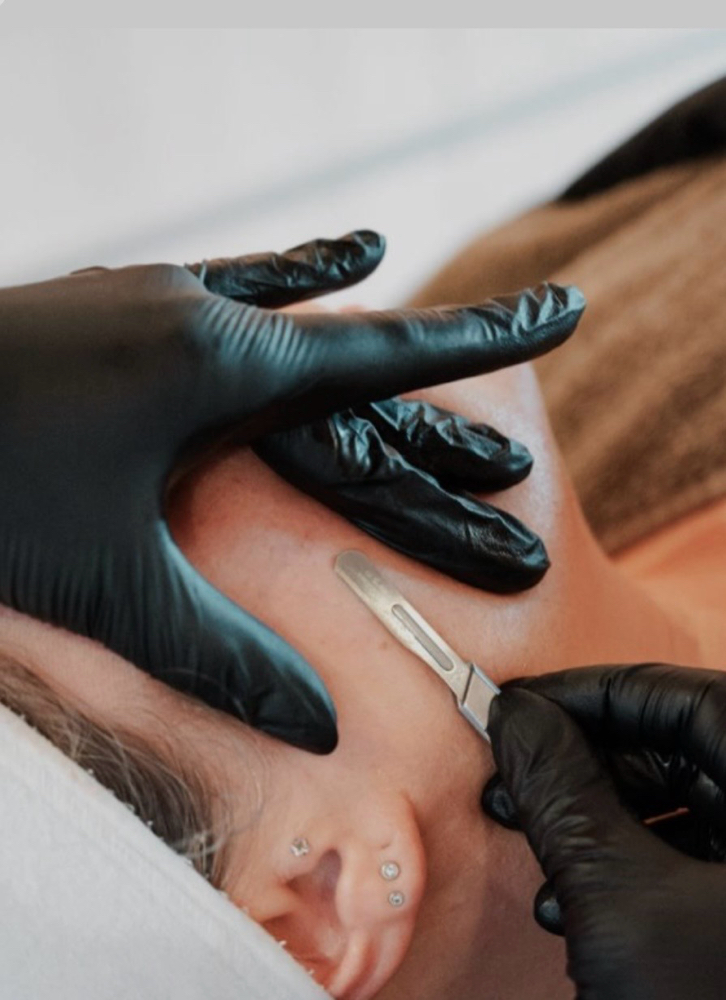 Dermaplane Add On at Kathy's Skinbar in Fort Payne, AL