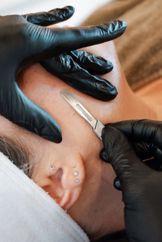 Dermaplane Add On