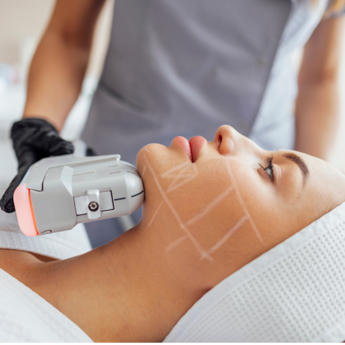 HiFU at Zoya Wellness Center in Rolling Meadows, IL