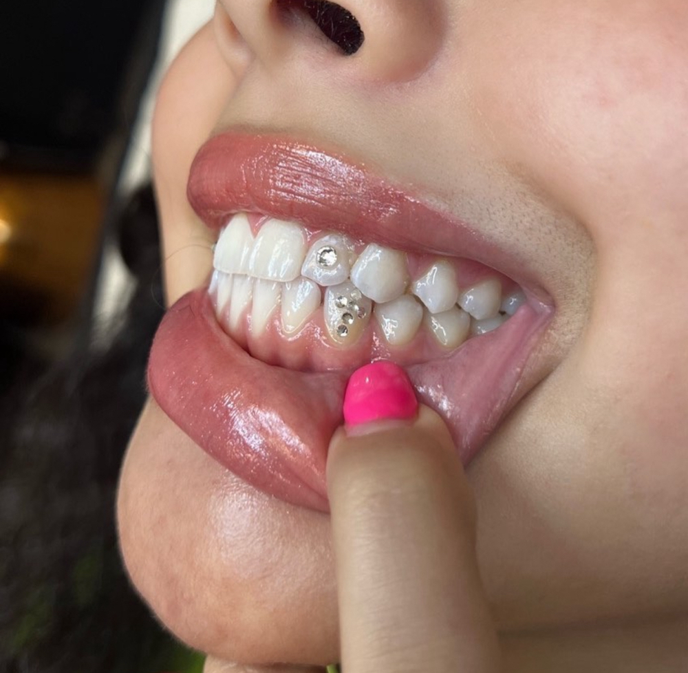 Cross Tooth Gems