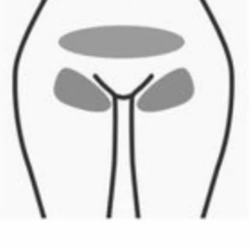 Women’s Bikini Full at Any body and everybody waxing studio LLC in Fairborn, OH