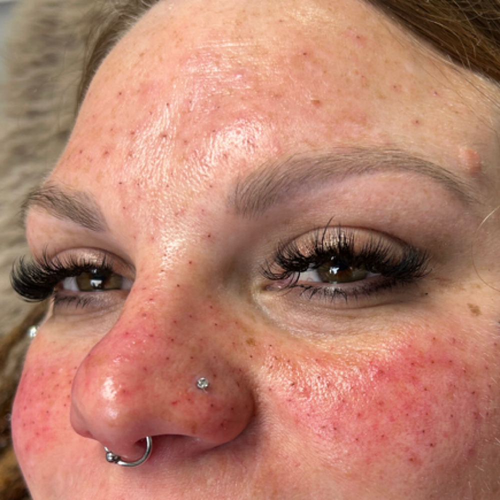 FRECKLE TATTOO - FULL COVERAGE at Greta’s Ink n Glam in Cottage Grove, OR