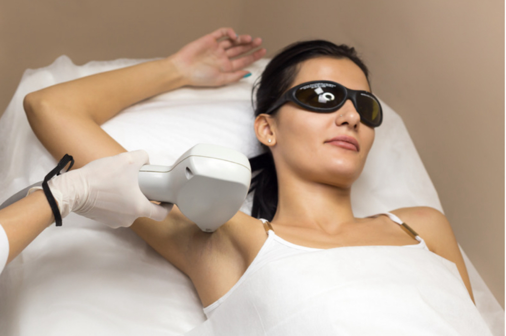 Laser Hair Removal (LHR)