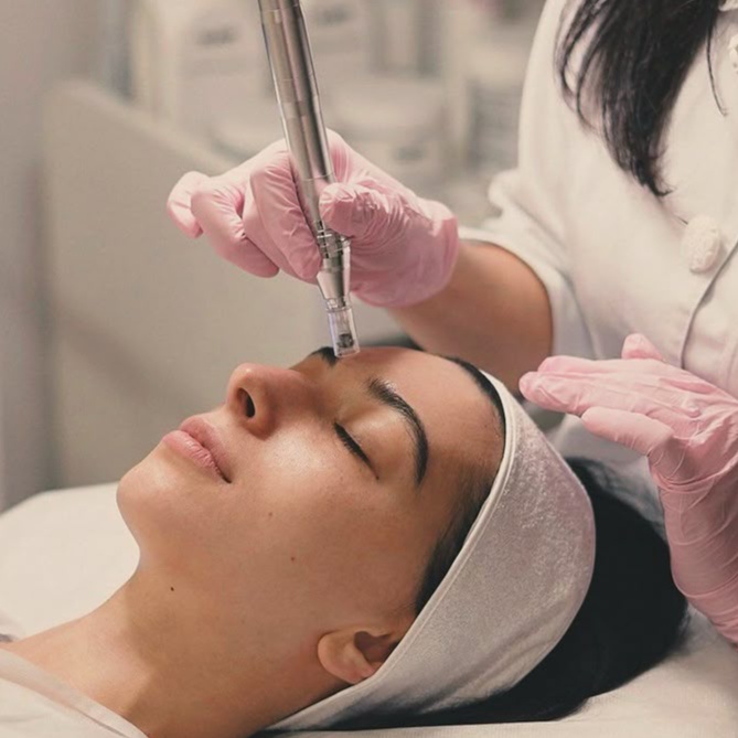 Microneedling Induction at All in one beauti and Training studio in Brooklyn, NY