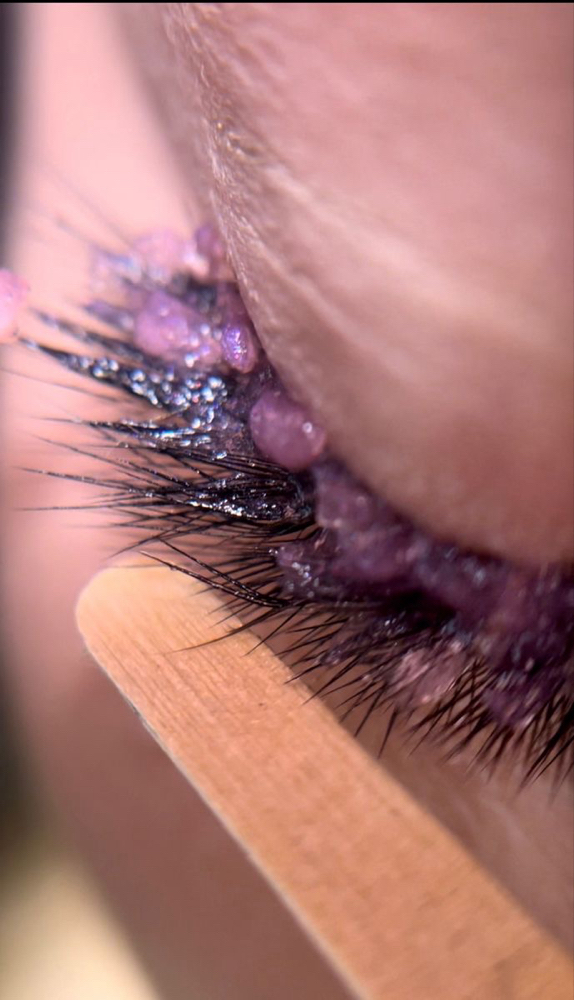 Lash Removal