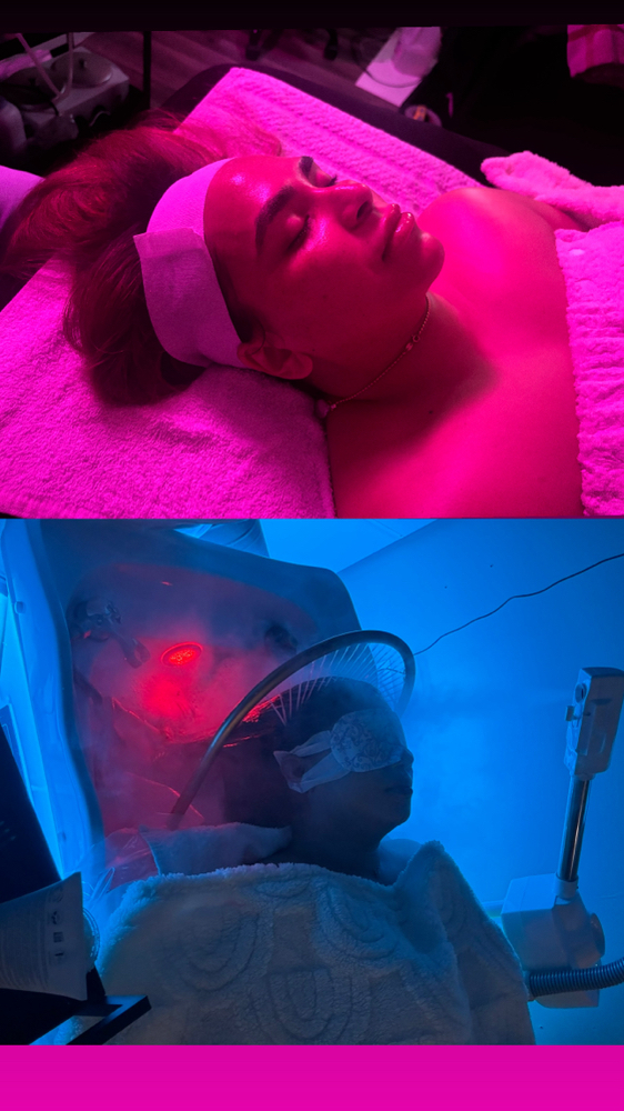 Scalp Massage & Facial Bundle at YG Aesthetics in Chicago, IL