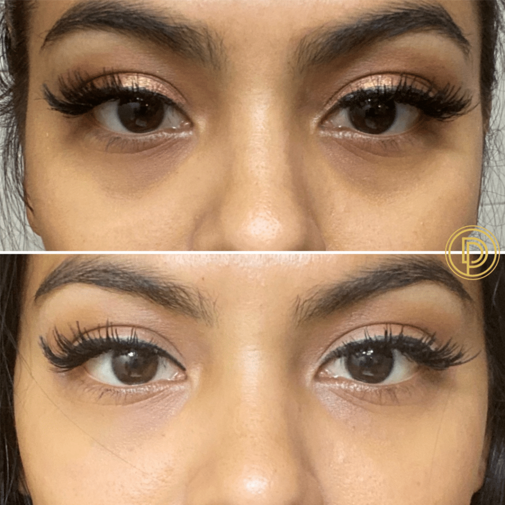Eye Rejuvenated at Bliss Beauty Bar in Houston, TX