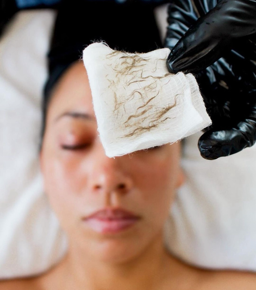 Dermaplaning Facial