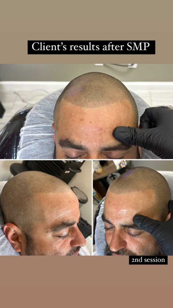 SMP Consultation at Utopia Beauté in El Paso, TX