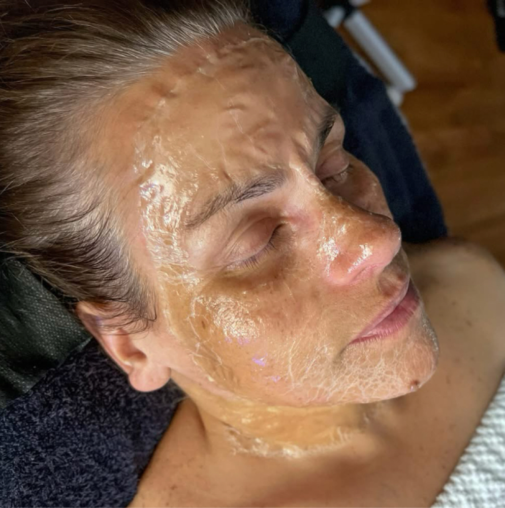 Better Than Botox at L&L Esthetics in Goshen, OH