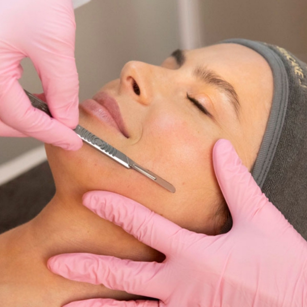 Dermaplaning ( Add On) at SJS Skinz in Brandon, FL