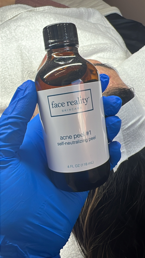 Face Reality Acne Treatment