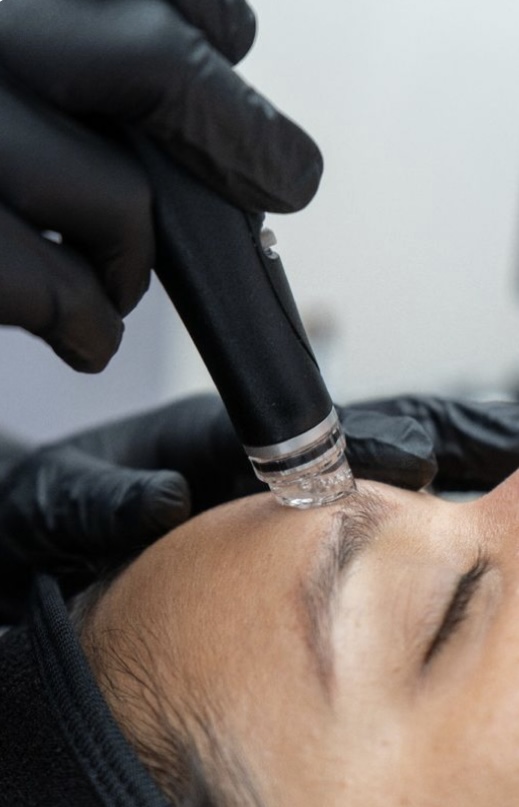 Platinum Hydrafacial