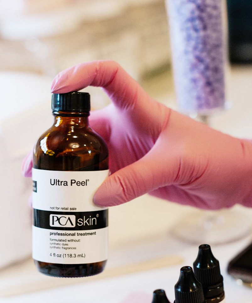 PCA Ultra Peel at Skin By Shelly in Port Washington, WI