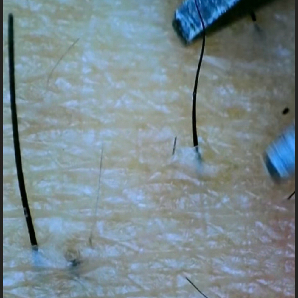 Intimate Extractions at Uniqla Beauty Lounge in Painesville, OH