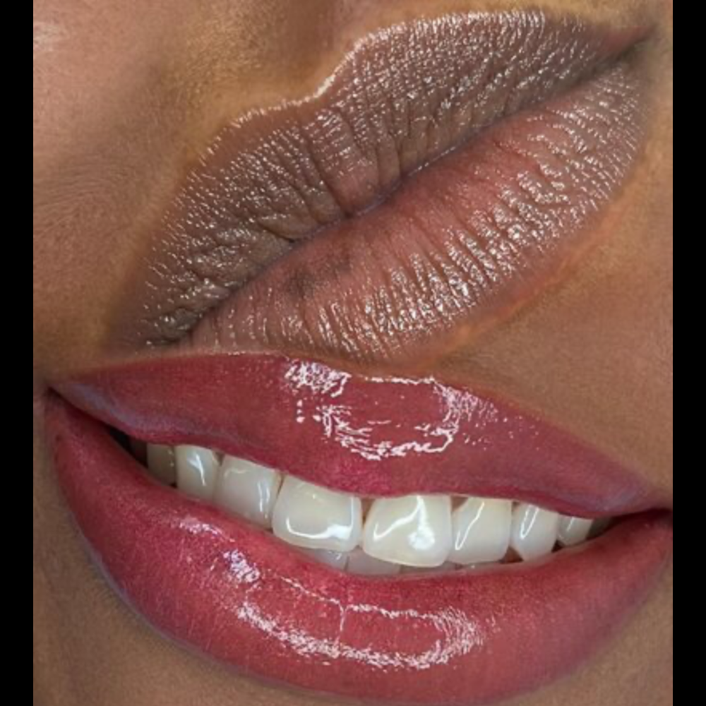 Lip Neutralization